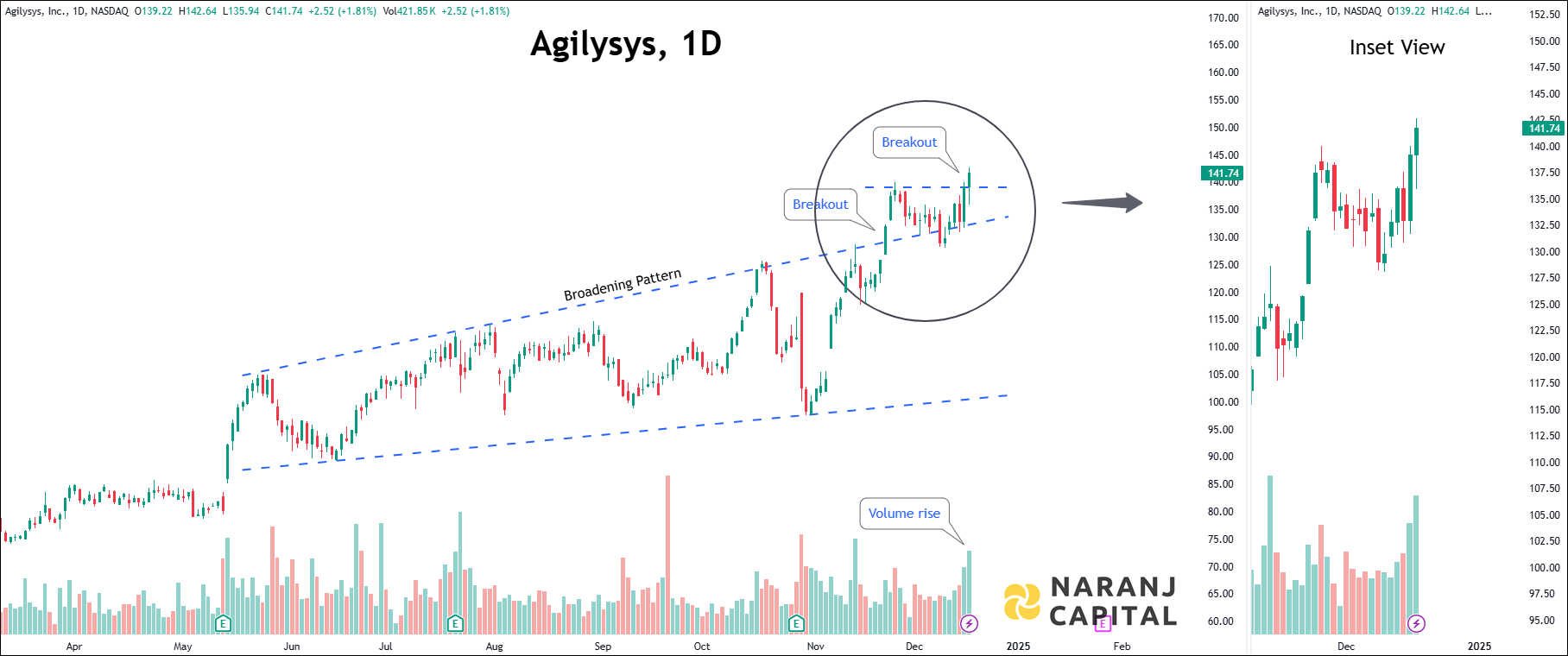 Agilysys Incorporation - Technical Analysis chart on Daily Price and Volume