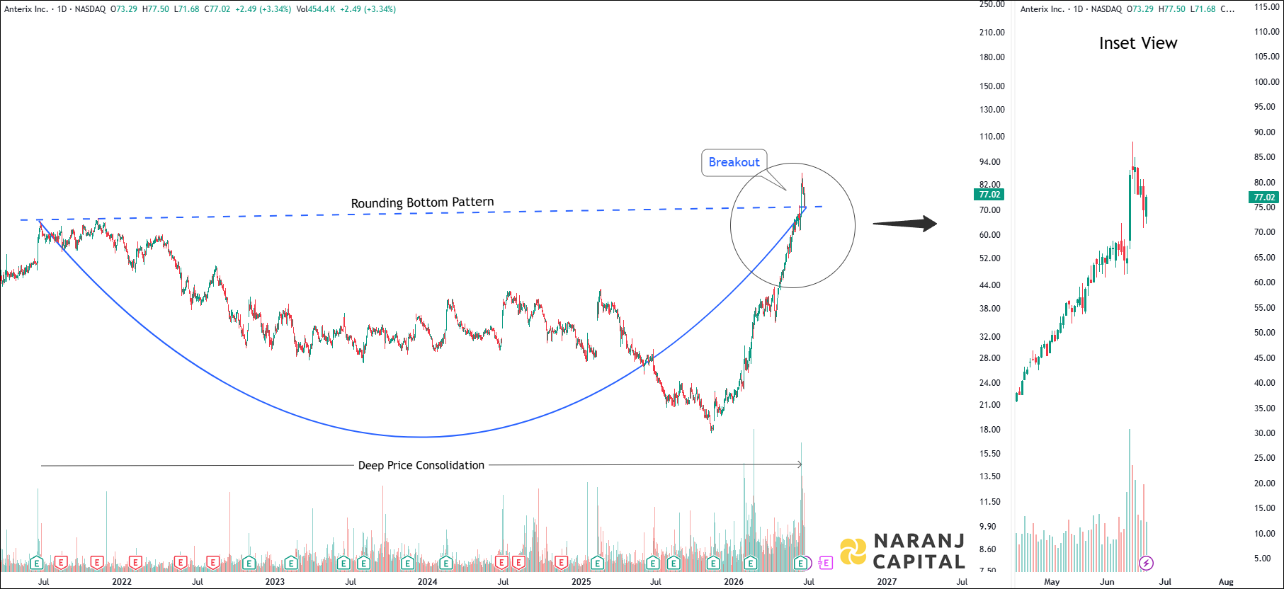 Anterix - Daily Technical Analysis